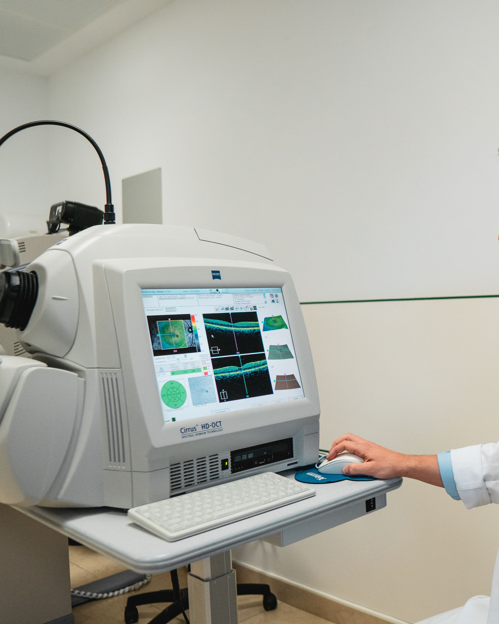 Contexto clínico do tratamento de retinopatia miópica na Oftalmologia Algarve